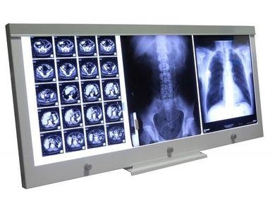 Zdjęcie Negatoskop LED NGP 31 z podstawą biurkową