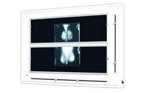 Zdjęcie Negatoskop żaluzjowy do mammografii NGP-41 mZ