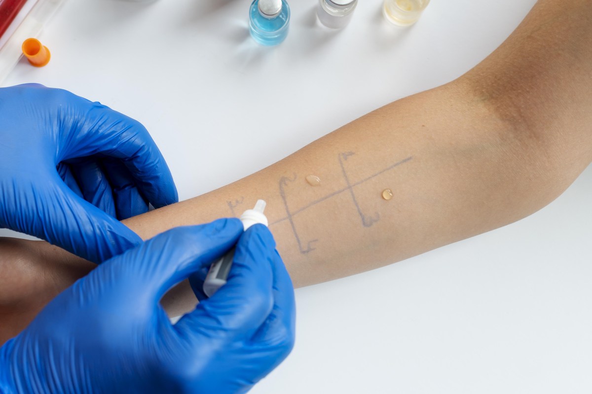 Farbowanie a alergia - jak zrobić próbę uczuleniową?